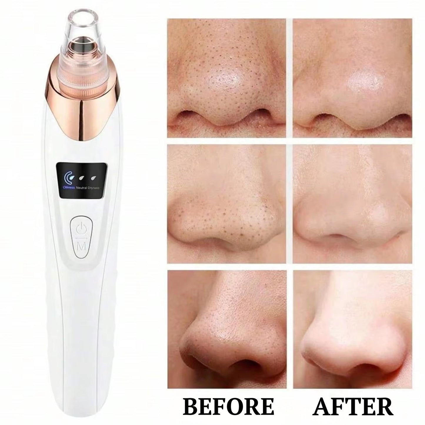 Blackhead Vacuum Pro