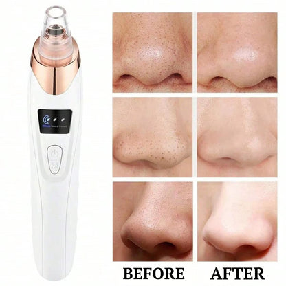 Blackhead Vacuum Pro